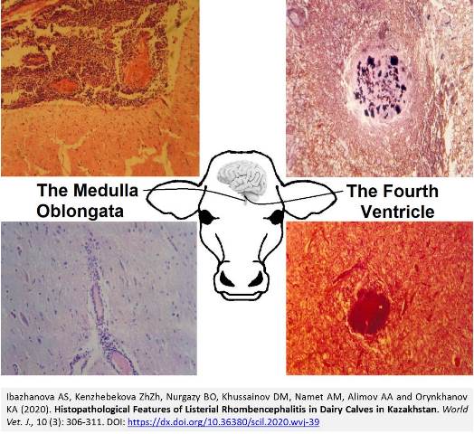 Listerial_Rhombencephalitis_-1288_low